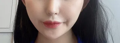 [Da đẹp] DaGyoungDaGyoung - Ulthera, Airjet