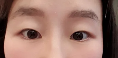 [Mắt] Megalodon - Mắt