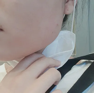 [Tiêm thẩm mỹ] seoul - Botox cằm