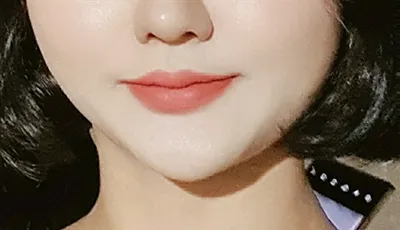 [Tiểu phẫu] Dani Ryung - Tiêm tan mỡ, Botox cằm