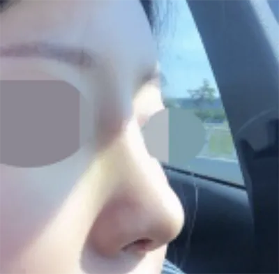 [Mũi] ggggghhhhhhhh - Mũi