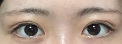 [Mắt] Kwon Dong-ha - Mắt