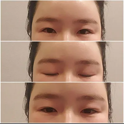 [Mắt] appleseh - Mắt