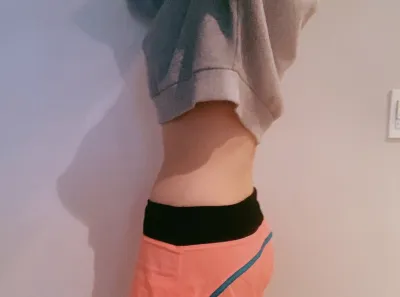 [Hút mỡ] yedu87 - Hút mỡ chân, bụng