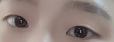 [Mắt] LeeSoo - Bấm mí, mở góc mắt trước