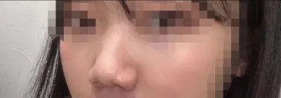 [Mũi] Sao không nghe máy vậy - Mũi