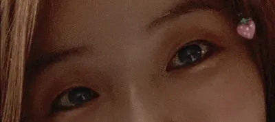 [Mắt] Habahaha - Chỉnh sửa mí mắt, cắt mí