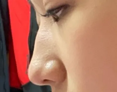 [Mũi] Đầu mũi tròn - Mũi (silicone)