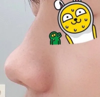 [Mũi] Bichon Shong Shong Shol - Mũi