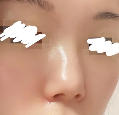 [Mũi] Yomiseu - Mũi