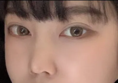 [Mũi] Babobo - Mũi