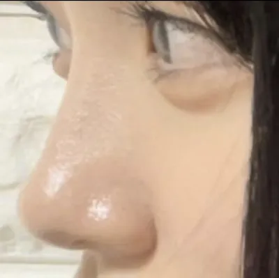 [Mũi] Ttottoi1 - Mũi