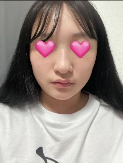 [Mũi] Ming Kain - Mũi