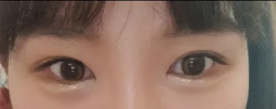 [Mắt] Zingphilius - Mắt