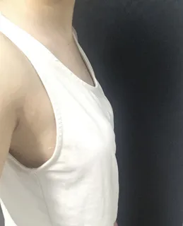 [Ngực] 2 giờ chiều - Ngực