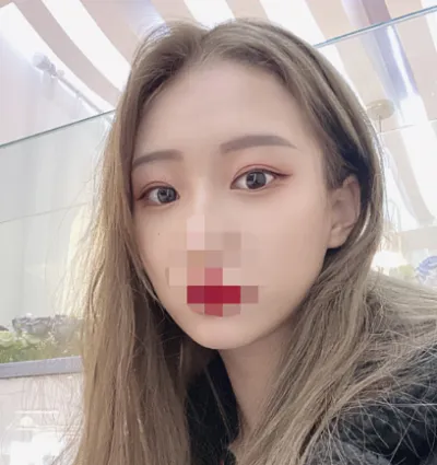 [Mắt] Gu Seul - Mắt