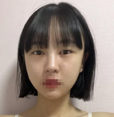 [Mắt] Donggeul e - Mắt