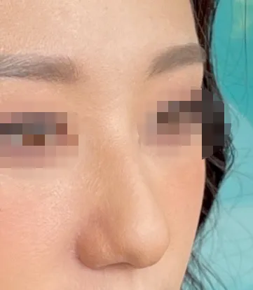 [Mũi] Black Panther - Mũi