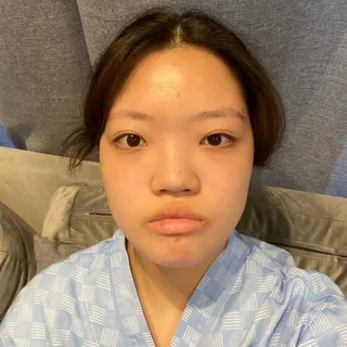 [Mũi] Elsa - Mắt, Mũi