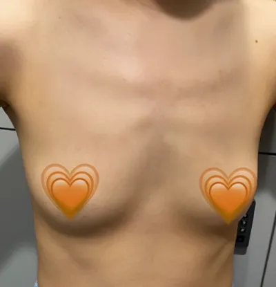 [Ngực] Căng tròn như bóng - Ngực