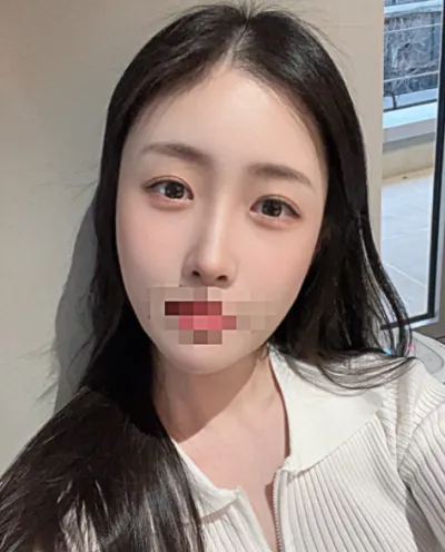 [Mắt] Shin Nosuke - Mắt