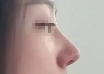 [Mũi] Minjjang - Mũi