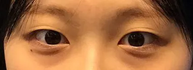 [Mắt] Coca-Cola - Mắt