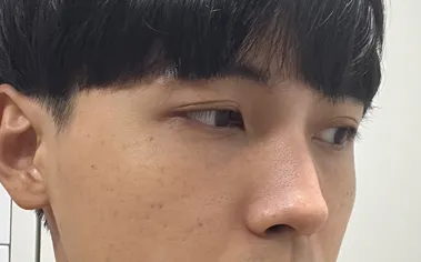 [Mũi] Một tháng - Mũi, Đường nét khuôn mặt