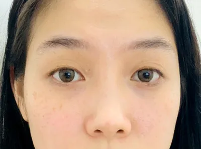 [Mắt] Beth Girl - Mắt, Mũi