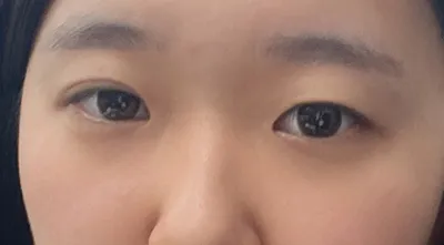 [Mắt] My Melody - Mắt, Mũi