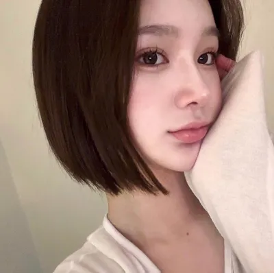 [Mũi] Romi - Tái phẫu thuật mũi