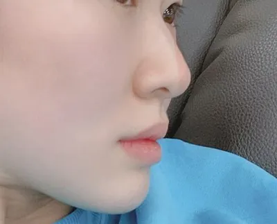 [Mũi] Mối tình đầu - Mũi