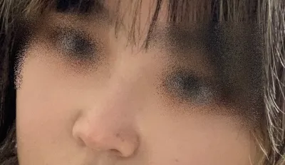 [Mũi] Jolasle v - Mũi