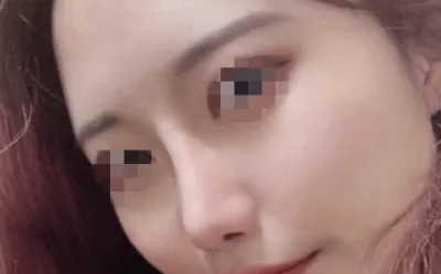 [Mũi] Moon Moon - Mũi