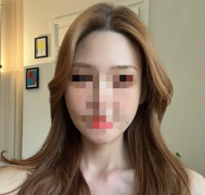 [Gọt mặt] LaView v2 - Gọt mặt