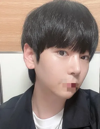 [Mũi] Target - Mũi