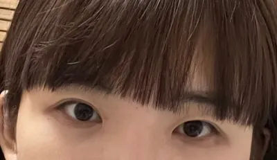 [Mắt] Ttung-a - Mắt