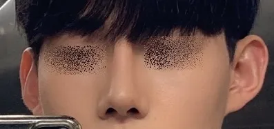 [Mũi] Ảnh bạn thân - Mũi