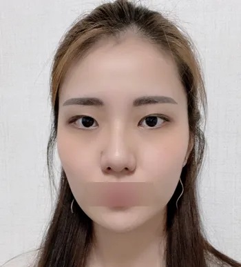 [Gọt mặt] Cảm ơn - Gọt mặt