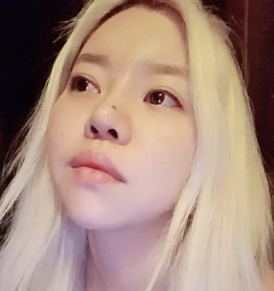 [Mắt] Tuyệt vời - Mắt, mũi, cấy mỡ