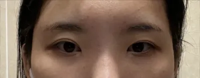 [Mắt] Tất cả mọi thứ - Mắt