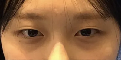 [Mắt] Eolleli - Mắt