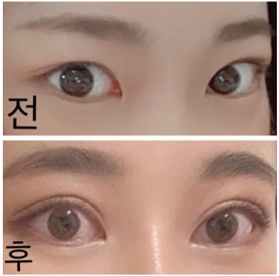 [Mắt] Hoho Ba - Mắt, mũi, nâng trán