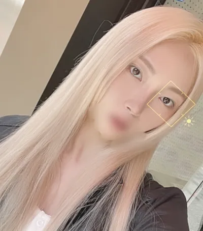 [Mũi] Elisha - Phẫu thuật mũi, tái tạo bọng mắt dưới