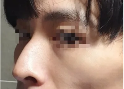 [Mũi] Haru Sari - Mũi