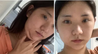 [Gọt mặt] Giấy ăn - Đường nét, mũi