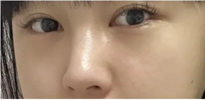 [Mắt] Đỏ - Mắt, Mũi