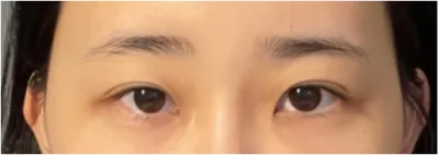 [Mắt] Yuson Magic - Mắt