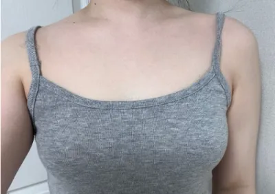 [Ngực] Tăng kích thước vòng 1 - Ngực