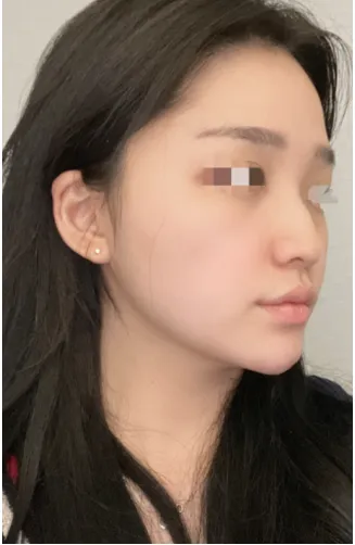 [Mũi] Love You - Mũi